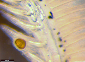 A glochidium of the mussel Hyridella drapeta attached to the gill rakers of an Australian smelt